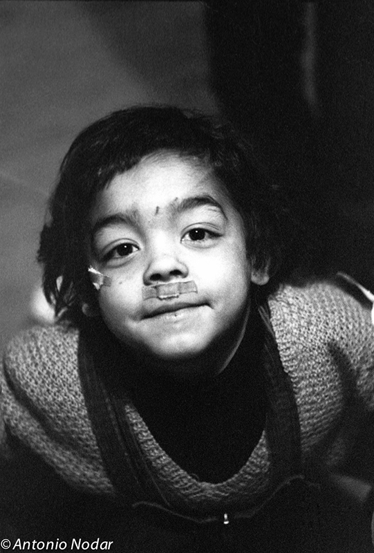 A close-up of a young child with short hair, sweaters, and small wounds and tape on the face, looking straight at the camera in Perona, Barcelona.